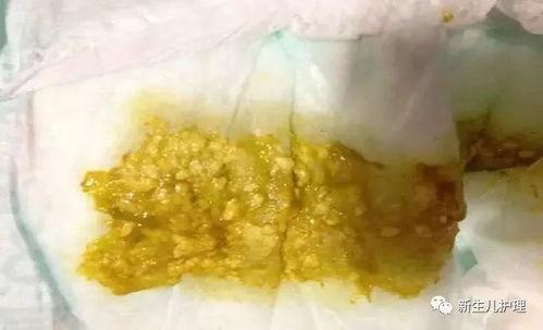 宝宝吃贝贝瓜便秘,贝贝瓜助力宝宝缓解便秘困扰